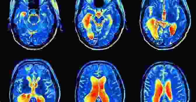 Brain Scan Showing Neural Activity During Anxiety Summary Guide: Unwinding Anxiety By Judson Brewer (BlinkRead)