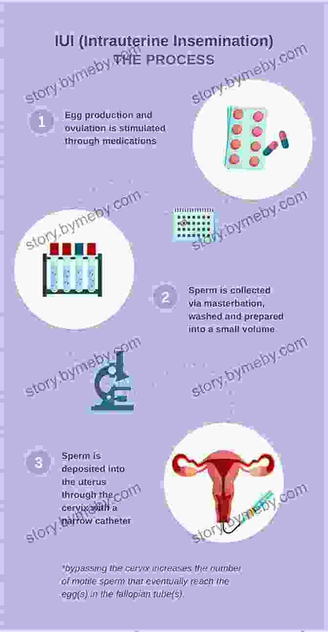 Diagram Of The IUI Procedure Infertility Management Series:Intrauterine Insemination