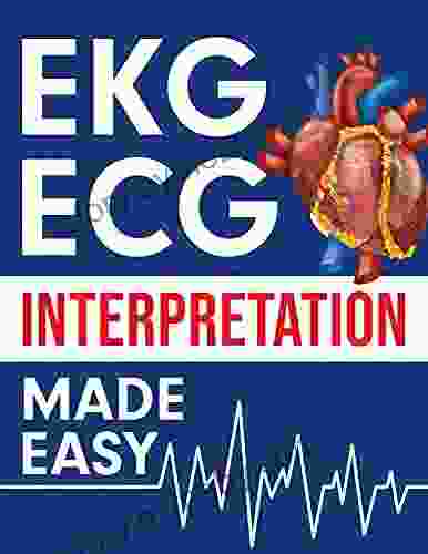 EKG ECG Interpretation Made Easy: An Illustrated Study Guide For Students To Easily Learn How To Read Interpret ECG Strips